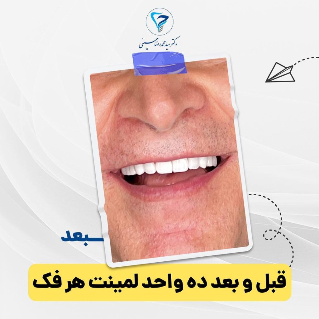 بهترین متخصص ایمپلنت در سعادت آباد