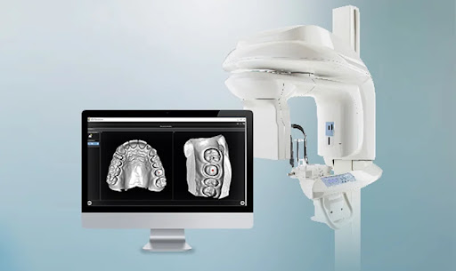رادیوگرافی دیجیتال دندان