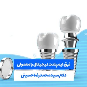 فرق ایمپلنت دیجیتال با معمولی