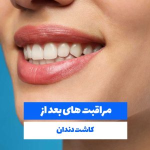 مراقبت بعد از کاشت دندان